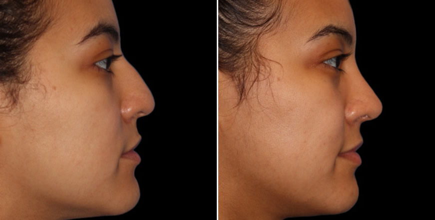 Plastic Surgery Results